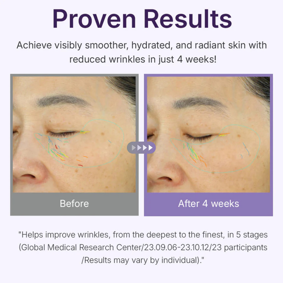 Centellian24 Expert Madeca Cream Active Renew PDRN