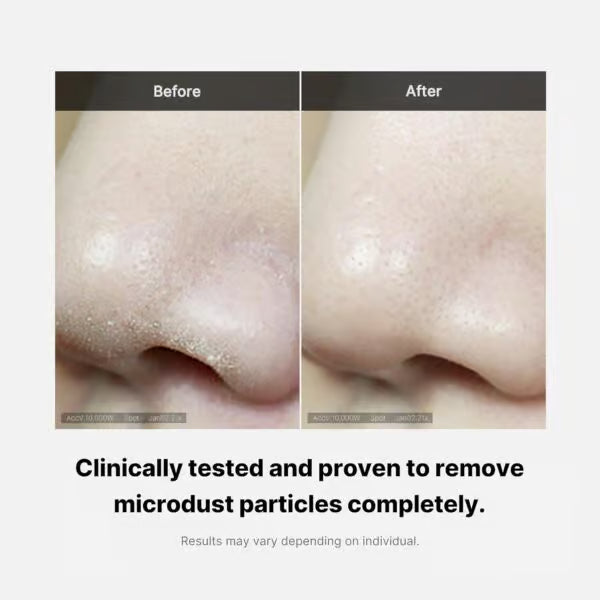 Medicube Zero Foam Cleanser 120ml | Gentle Daily Cleanser